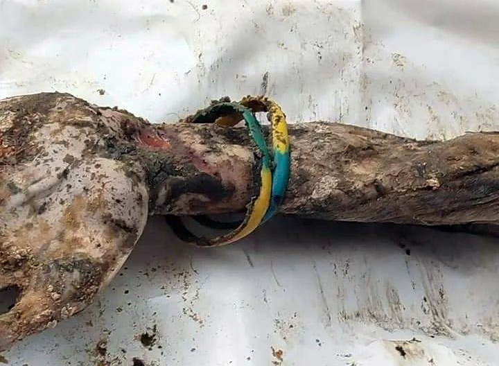 рука жовто блакитний браслет ізюм